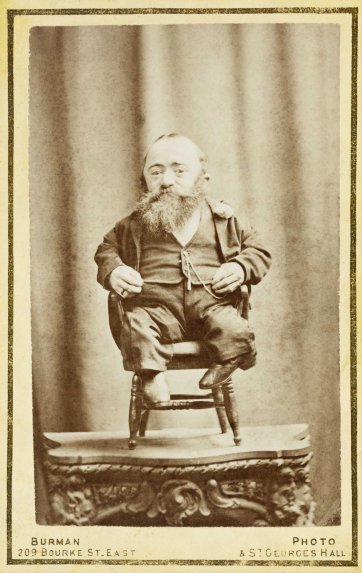 At the Pantechnetheca, Exhibition, Eastern Arcade, Dominick Sonsee, the smallest man in the world, c. 1880 by William Burman At the Pantechnetheca, Exhibition, Eastern Arcade, Dominick Sonsee, the smallest man in the world, c. 1880 by William Burman