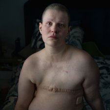 Breast cancer, age 37, 2021 Cat Leedon