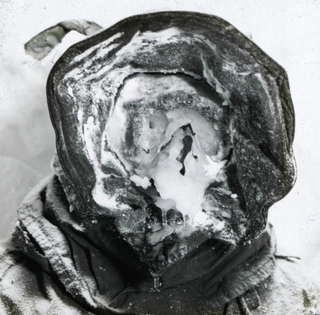 The meteorologist with an ice-mask, c. 1913
